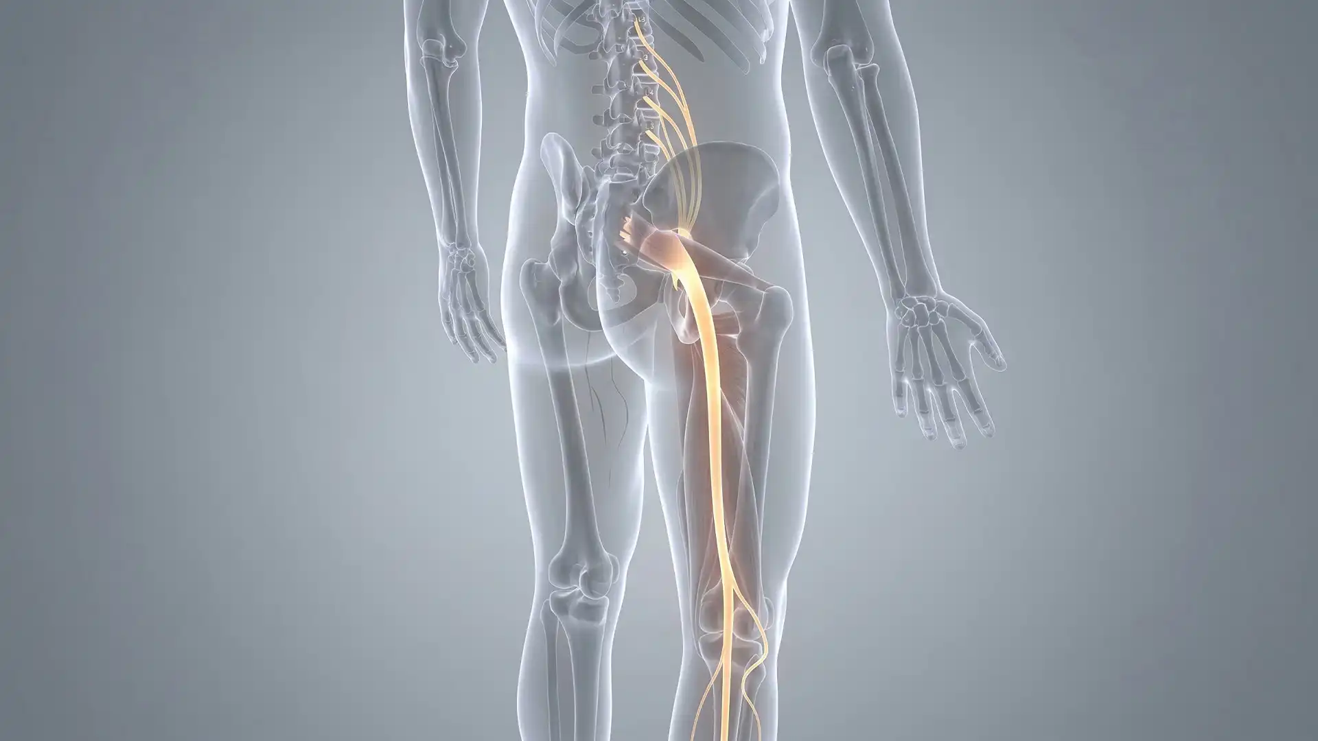 Radiofrequency Ablation Phoenix | Long-Lasting Pain Relief