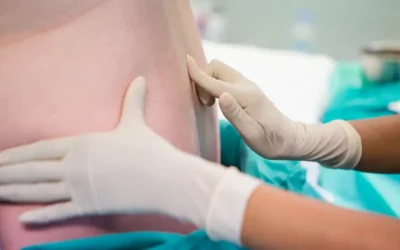 How Long Do Epidural Steroid Injections Last?